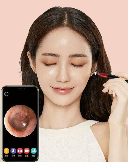 1080P WiFi Home Endoscope – Clear Inspection for Home & Beauty 1
