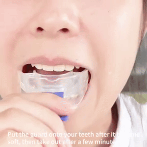 Clear Dental Retainers - Affordable Custom Fit Solution 1