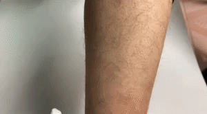 Crystal Hair Eraser - Painless Hair Removal Solution 1